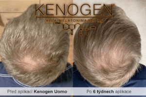 Clinical Hair&Health trichologická klinika
